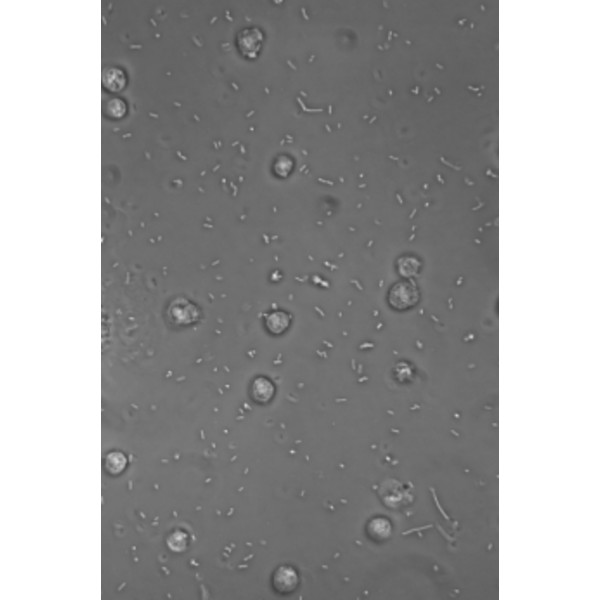 Microscope Hund Medicus PH Plan, trino, 100x-1000x