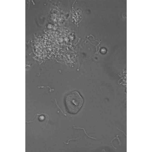 Microscope Hund Medicus PH Plan, trino, 100x-1000x
