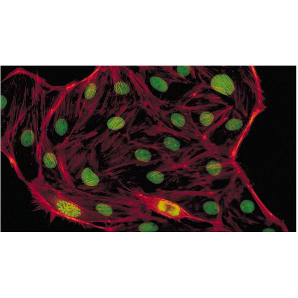 Evident Olympus Mikroskop CX41 Fluoreszenz, trino, Hal, 40x,100x, 400x