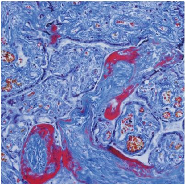 Microscope Evident Olympus CX41 pathologie, ergo, bino, Hal,  40x,100x, 400x