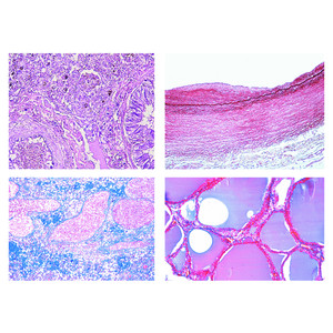 LIEDER Pathologische Histologie des Menschen, kleine Serie  (50 Präp)