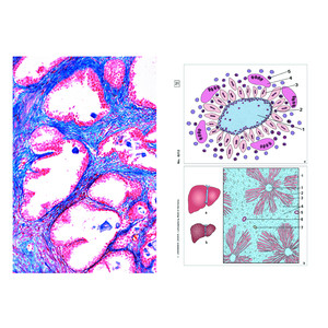 LIEDER Krankheiten des Menschen (Pathologie), Basis (6 Präp), Schülersatz