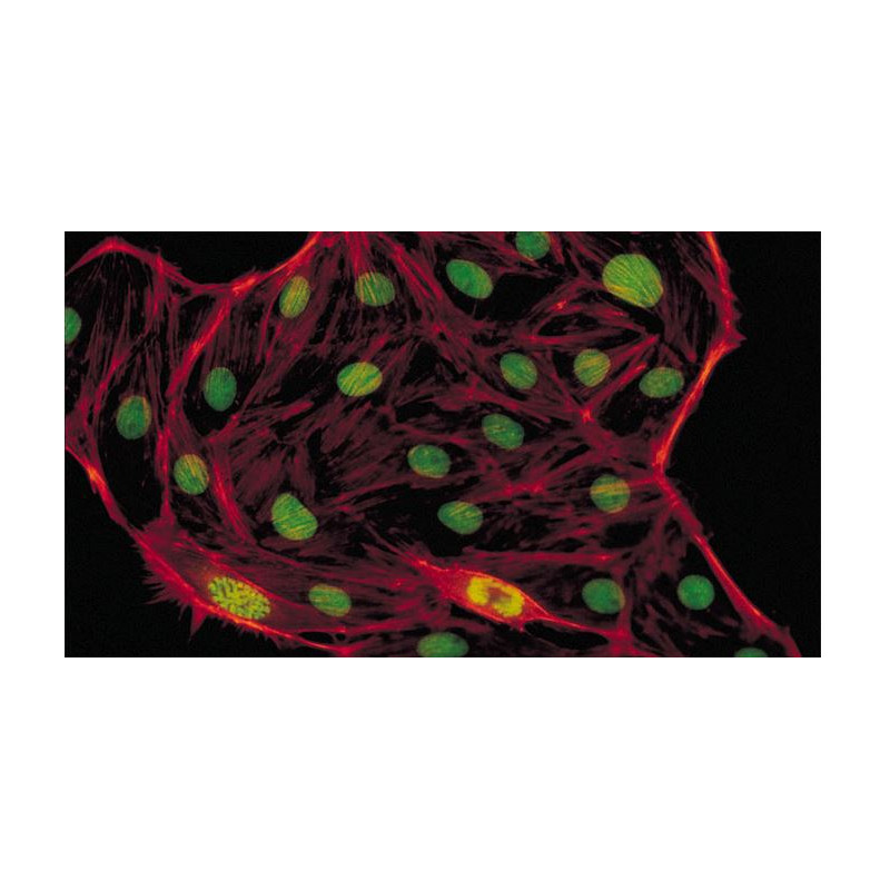Evident Olympus Mikroskop CX41 Fluoreszenz, trino, Hal, 40x,100x, 400x