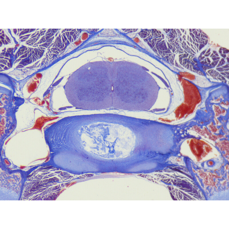 ZEISS Zoom-Stereomikroskop Stemi 355, C Lab, trino, BF, DF, w.d. 110mm, 10x/23, 5,5:1 , 7,2x-40x, AL/DL, Spot C LED